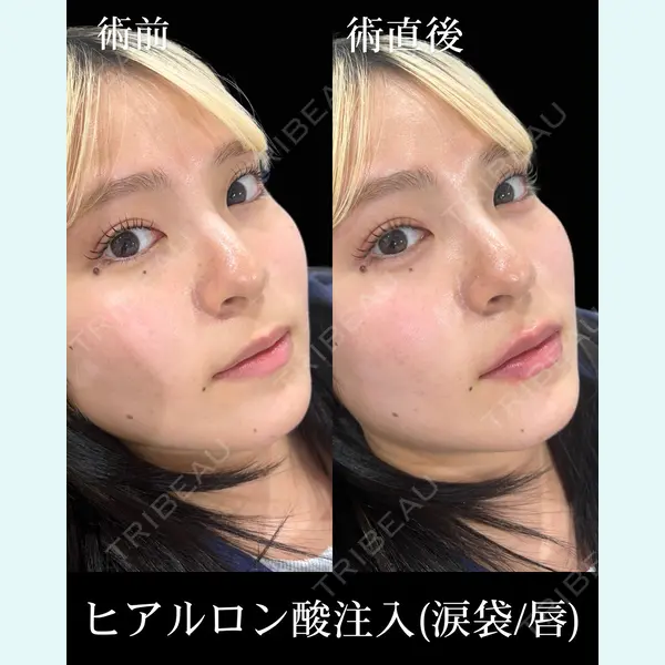 HAAB×DREAM BEAUTY CLINIC 東京本院 佐野 圭医師の症例