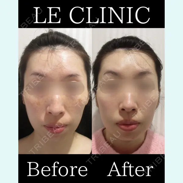 LE CLINIC 喜多　俊博医師の症例