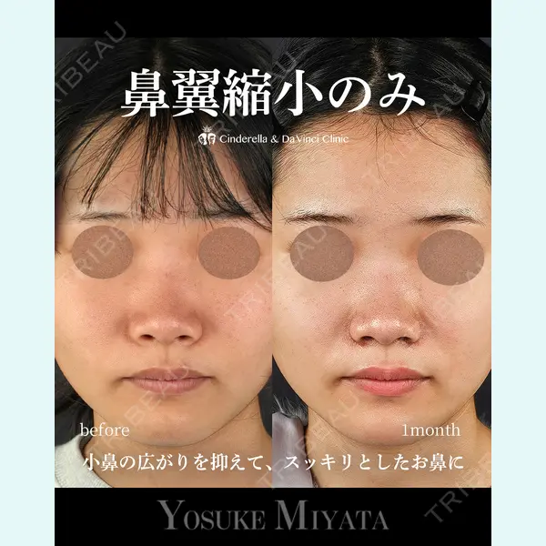 シンデレラ＆ダヴィンチクリニック 宮田 洋佑医師の症例