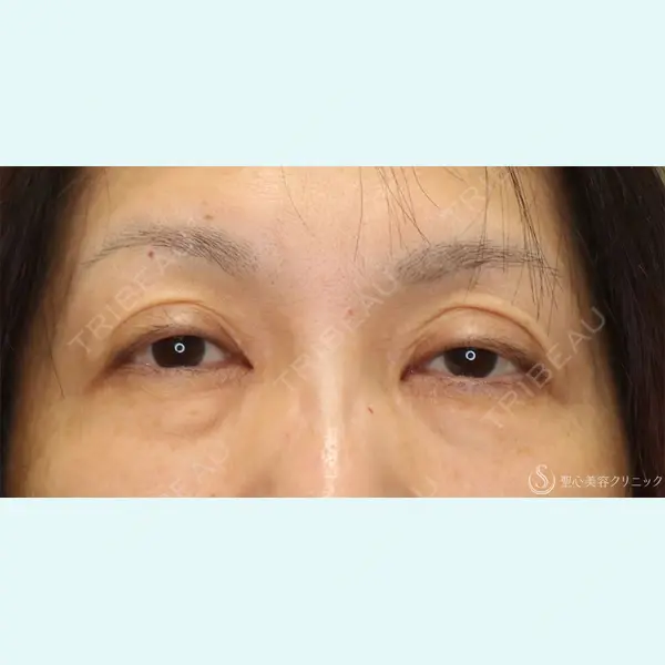 聖心美容クリニック 名古屋院 加藤 大典医師の症例