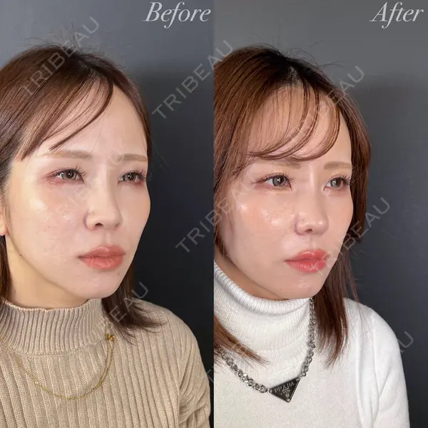 R Beauty CLINIC 大阪院 小池 泰弘医師の症例
