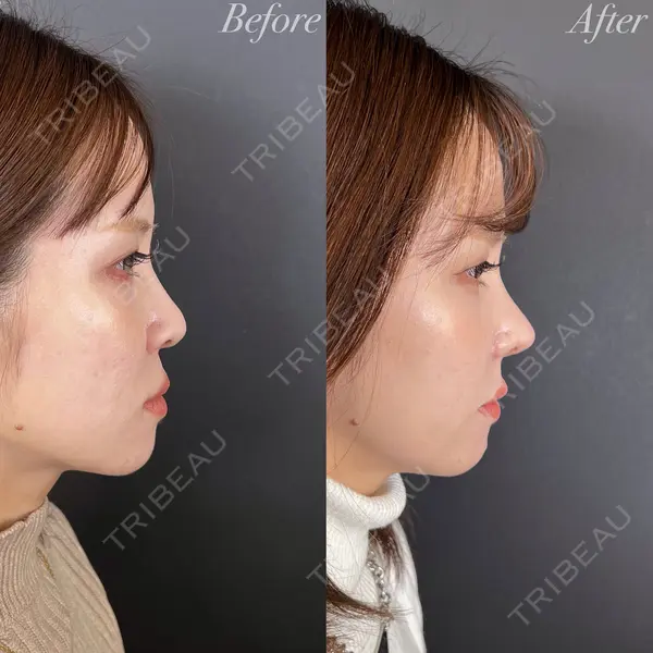 R Beauty CLINIC 大阪院 小池 泰弘医師の症例