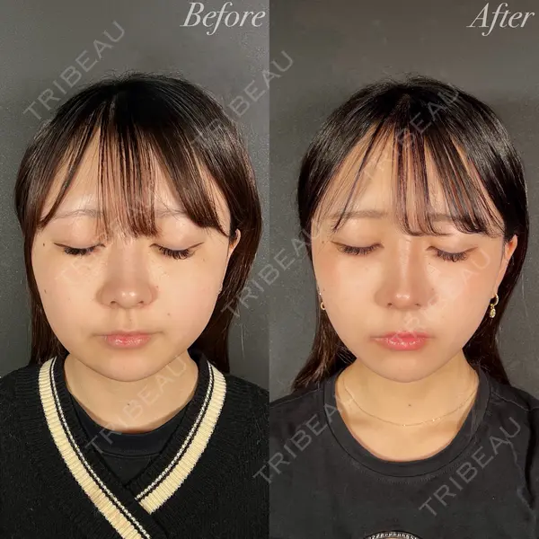 R Beauty CLINIC 大阪院 小池 泰弘医師の症例