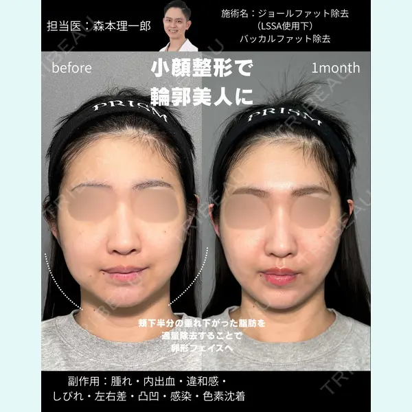PRISM Beauty Clinic 新宿院の症例