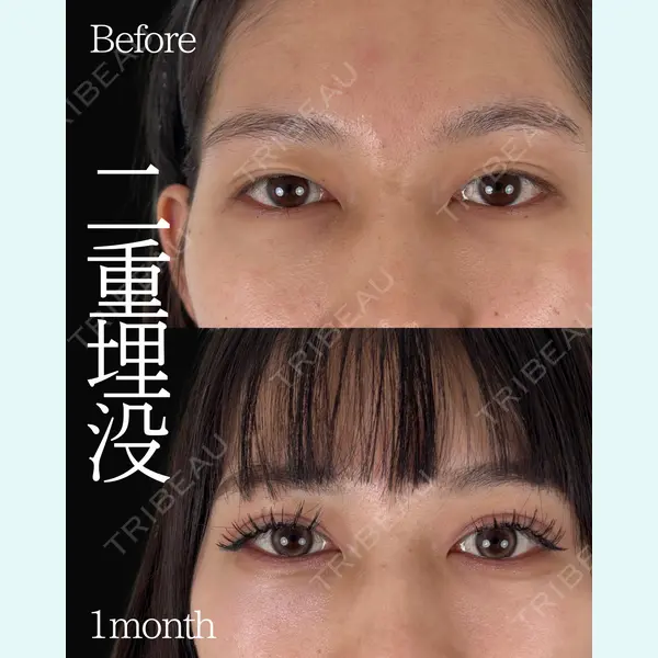 ネビュラクリニック 東京錦糸町院 岩切 琢磨医師の症例