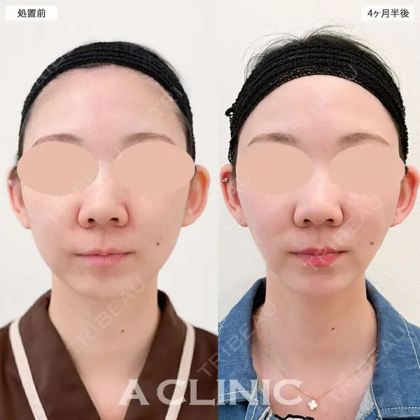 A CLINIC（エークリニック） 大阪院 田窪 賢志郎医師の症例