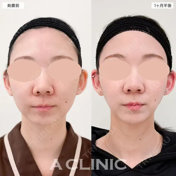 A CLINIC（エークリニック） 大阪院 田窪 賢志郎医師の症例