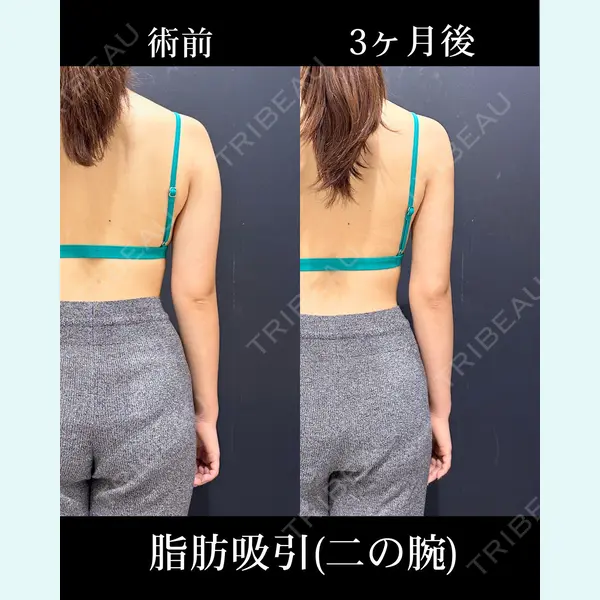 HAAB×DREAM BEAUTY CLINIC 東京本院 吉岡 修一医師の症例