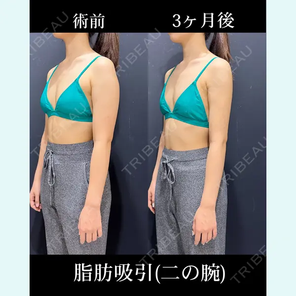 HAAB×DREAM BEAUTY CLINIC 東京本院 吉岡 修一医師の症例