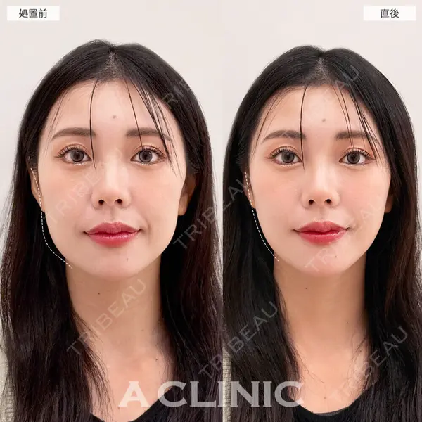 A CLINIC（エークリニック） 大阪院 田窪 賢志郎医師の症例