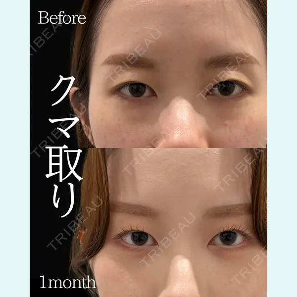 ネビュラクリニック 東京錦糸町院 岩切 琢磨医師の症例