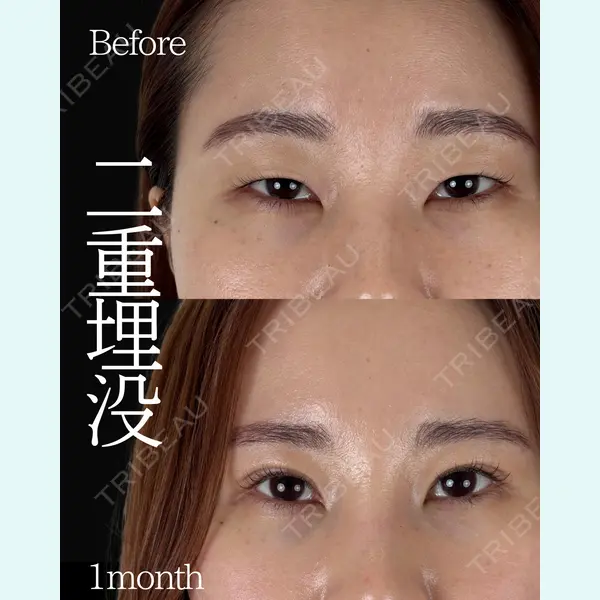 ネビュラクリニック 東京錦糸町院 岩切 琢磨医師の症例