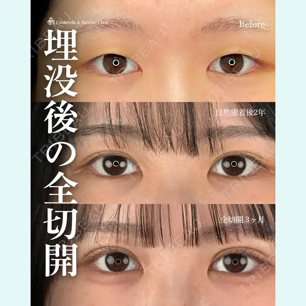 シンデレラ＆ダヴィンチクリニック 宮田 洋佑医師の症例