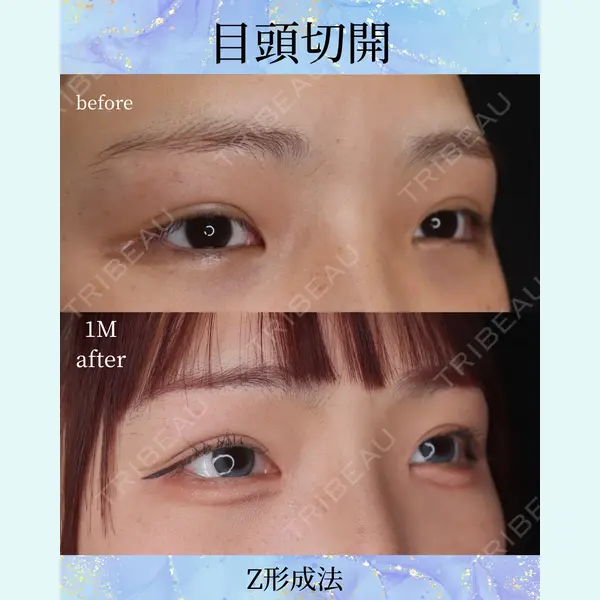 千葉美容外科アイビークリニックの症例