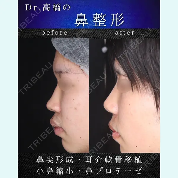 吉祥寺アイビークリニック 高橋 京佑 医師の症例