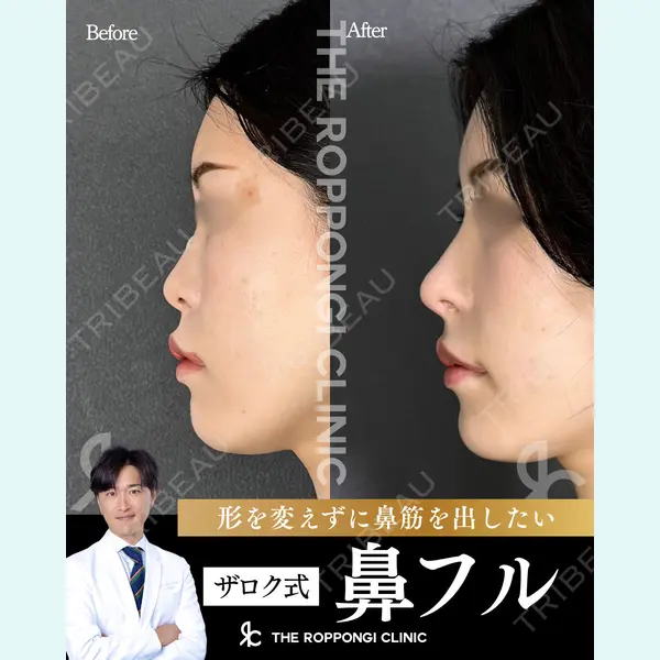 THE ROPPONGI CLINIC（ザ 六本木クリニック） 石黒 昂医師の症例