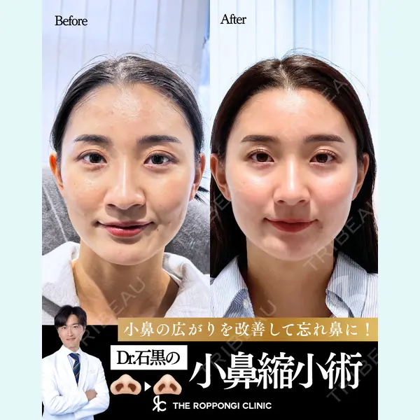 THE ROPPONGI CLINIC（ザ 六本木クリニック） 石黒 昂医師の症例