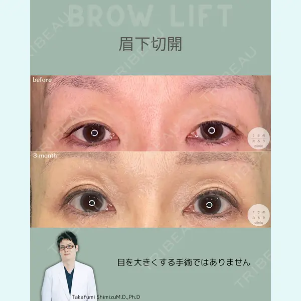 くさのたろうクリニック 清水 崇史医師の症例