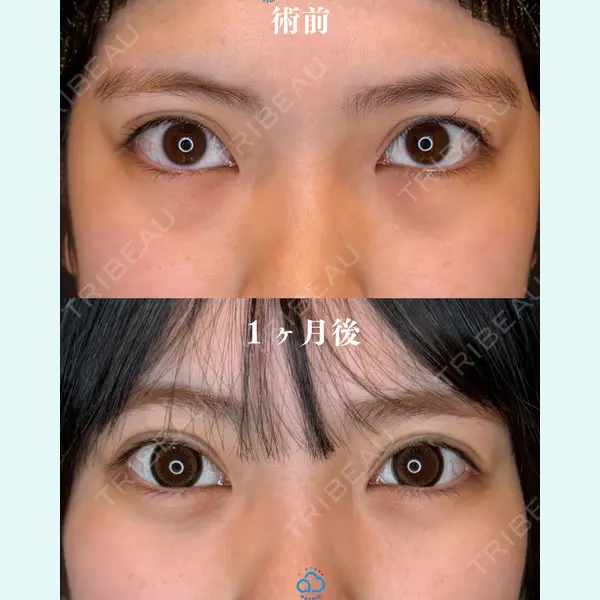 渋谷あおぞらクリニック美容外科・美容皮膚科 鶴田 優希医師の症例