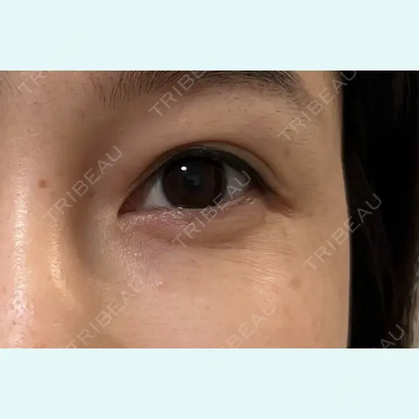 しんゆり美容健康クリニックの症例