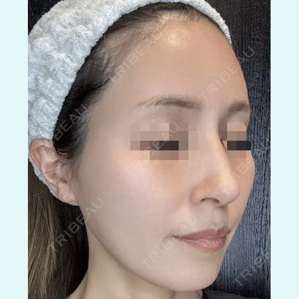 REVI CLINIC銀座院 の症例