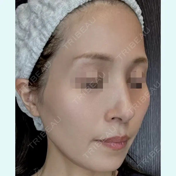REVI CLINIC銀座院 の症例
