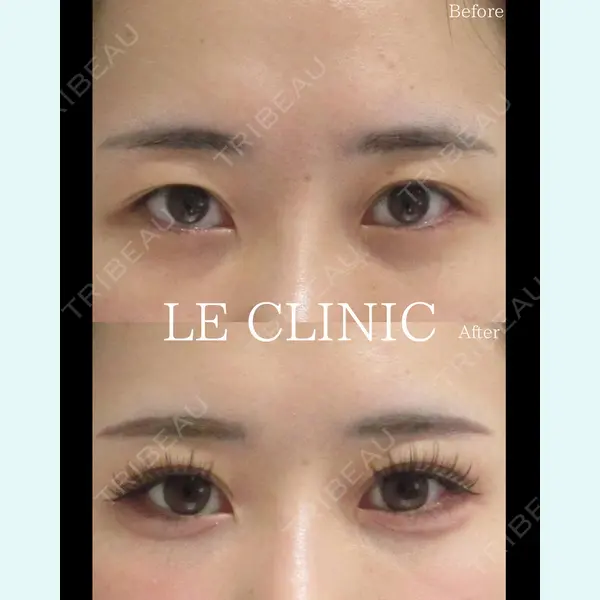 LE CLINICの症例