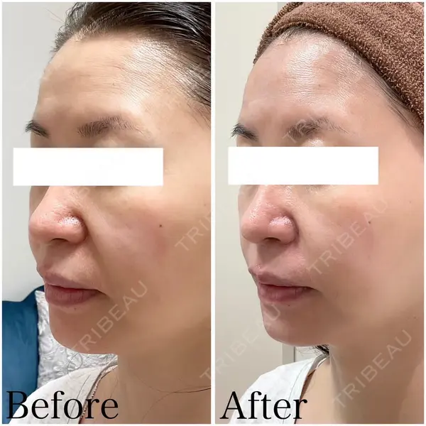 日本ウェルネス再生クリニックの症例