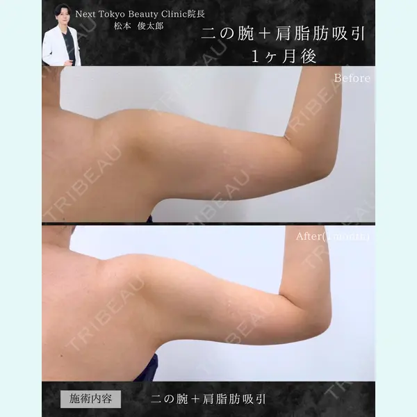 Next Tokyo Clinic 松本 俊太郎医師の症例