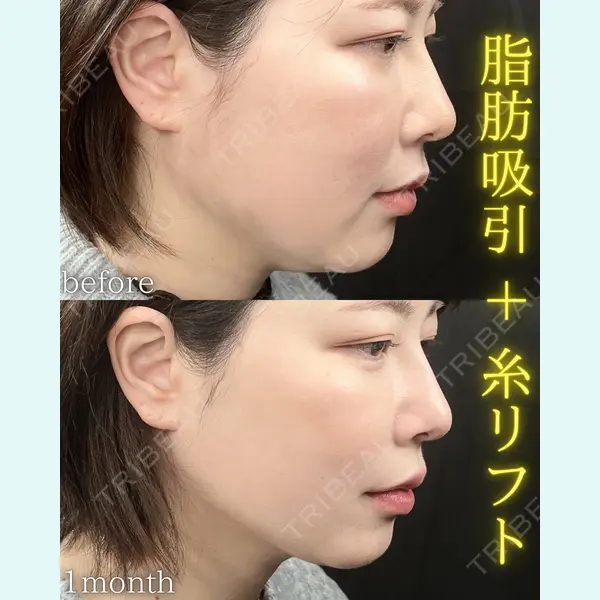 THE FIRST CLINIC 町田院の症例