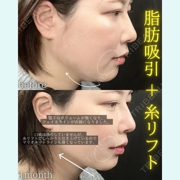 THE FIRST CLINIC 町田院の症例