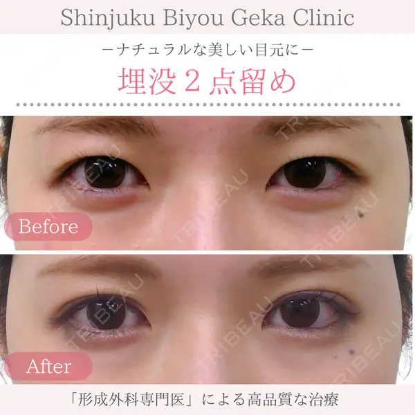 新宿美容外科クリニック 新宿院の症例