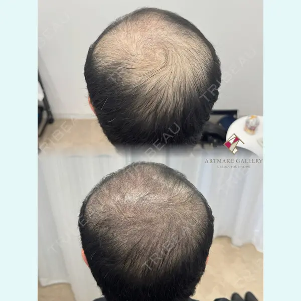 ギャラリークリニック 銀座 Okawa医師の症例