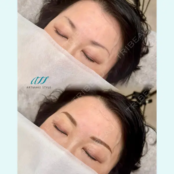 ギャラリークリニック 横浜院の症例