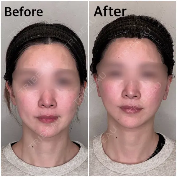 GRACY TOKYO CLINIC【グレイシートウキョウクリニック】 江本 正樹医師の症例