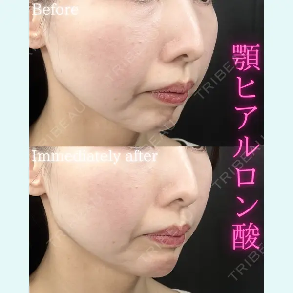 THE FIRST CLINIC 町田院の症例