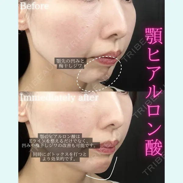 THE FIRST CLINIC 町田院の症例
