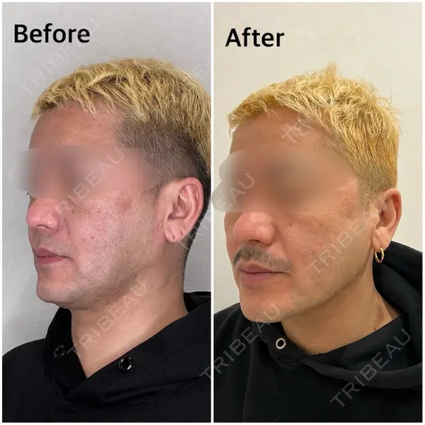 GRACY TOKYO CLINIC【グレイシートウキョウクリニック】 江本 正樹医師の症例