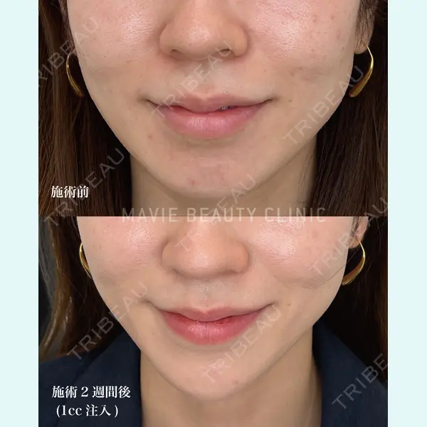 Mavie Beauty Clinic （マヴィービューティークリニック）の症例