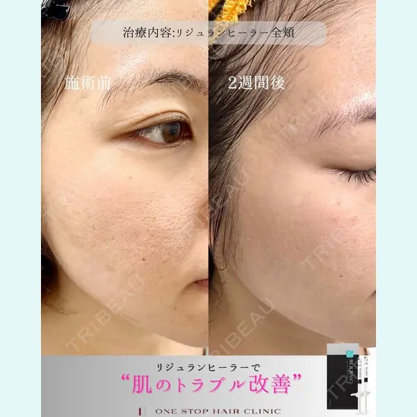 ワンストップヘアクリニック 大阪院 河合 駿医師の症例