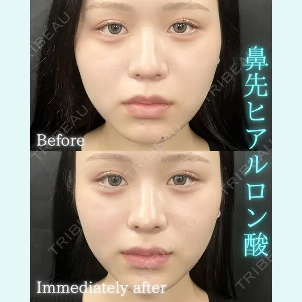 THE FIRST CLINIC 町田院の症例