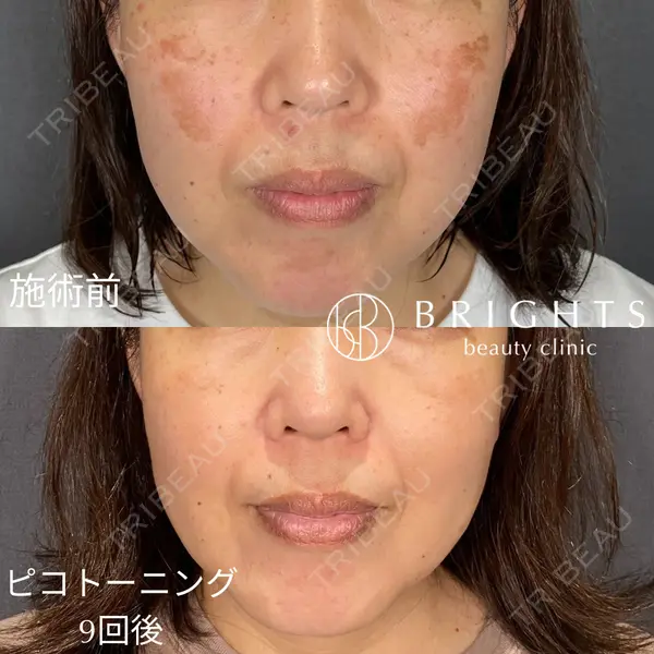 BRIGHTS beauty clinic 今村 直樹医師の症例