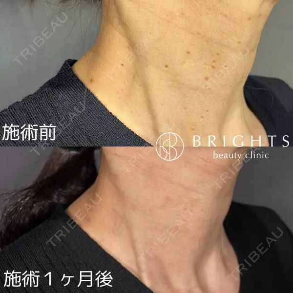 BRIGHTS beauty clinic 今村 直樹医師の症例