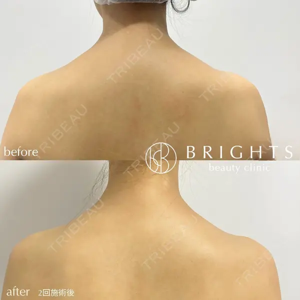 BRIGHTS beauty clinic 今村 直樹医師の症例