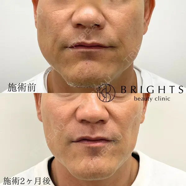 BRIGHTS beauty clinic 今村 直樹医師の症例