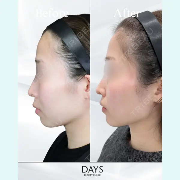 Days Beauty Clinic 新宿院の症例