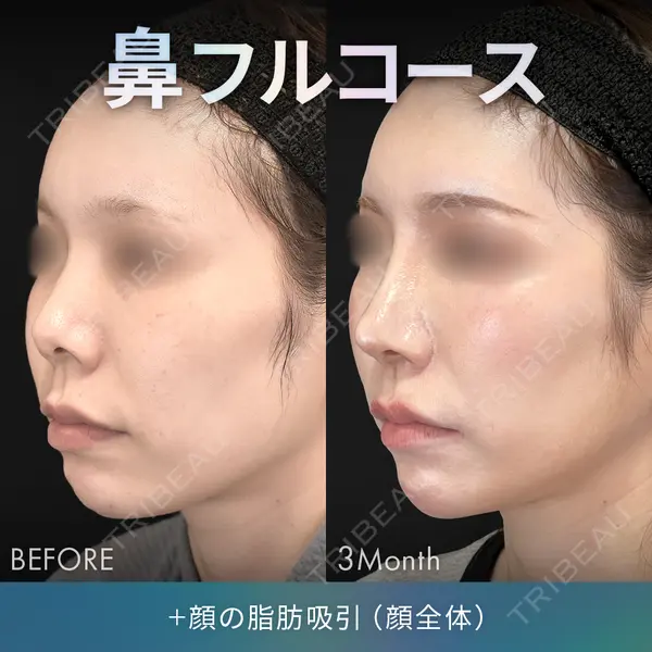 ジョウクリニック 銀座院 重本　譲医師の症例