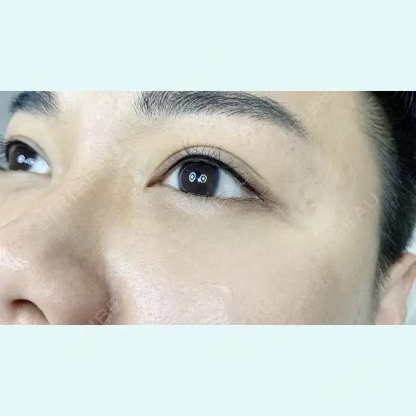 しんゆり美容健康クリニックの症例