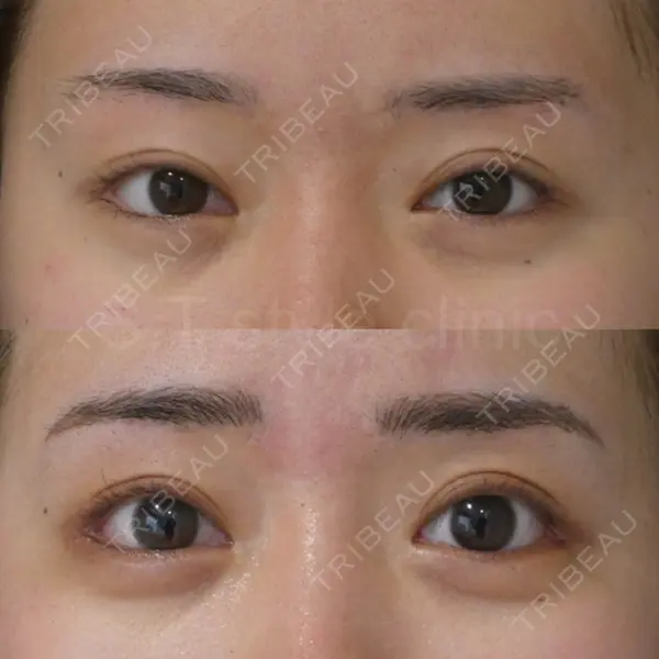 S.T styleクリニック 徳田 真紀子医師の症例