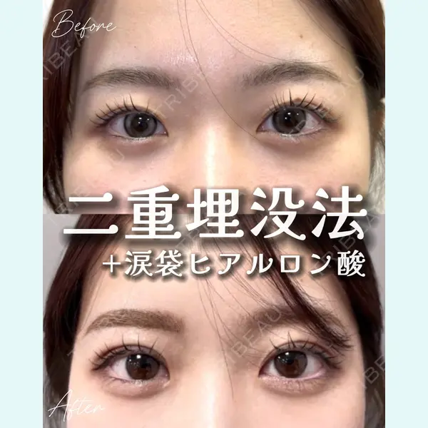 Tokyo Tensei Clinic 新宿院 小瀬 洸春医師の症例